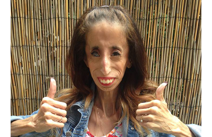 Lizzie Velásquez ha publicado ya tres libros de autoestima y positividad y es habitual en las conferencias TEDx.